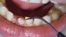 MGM Cancer Institute - mouth cancer symptoms