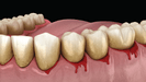 MGM Cancer Institute - throat cancer