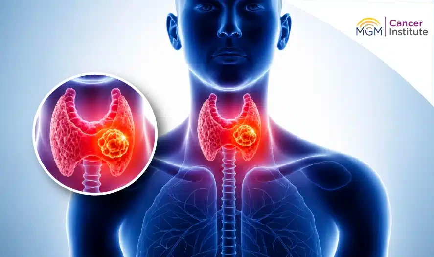 oncologist in chennai
