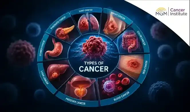 oncologist in chennai