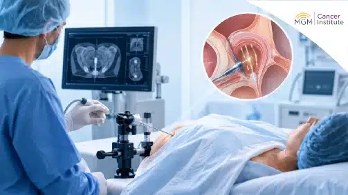 oncologist in chennai
