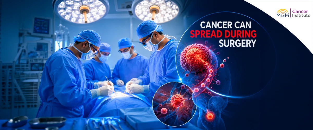 Cancer surgery myths vs facts does surgery spread cancer