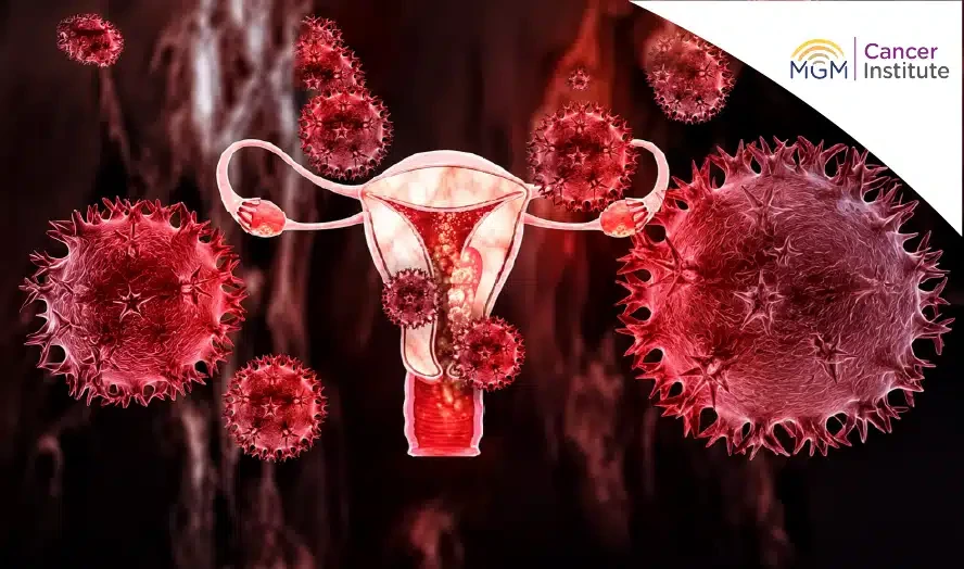 oncologist in chennai