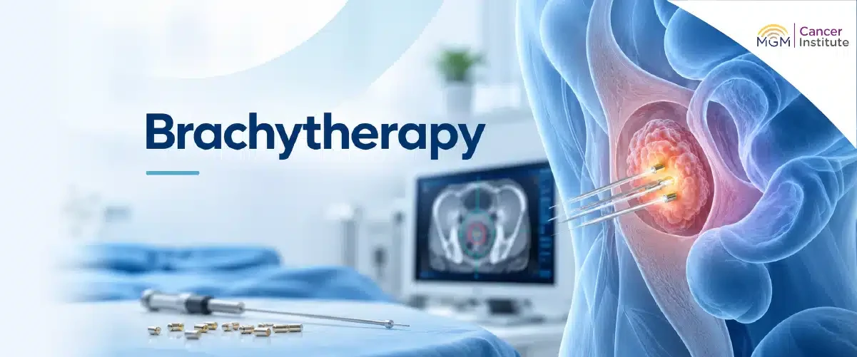 top 10 cancer hospital in chennai