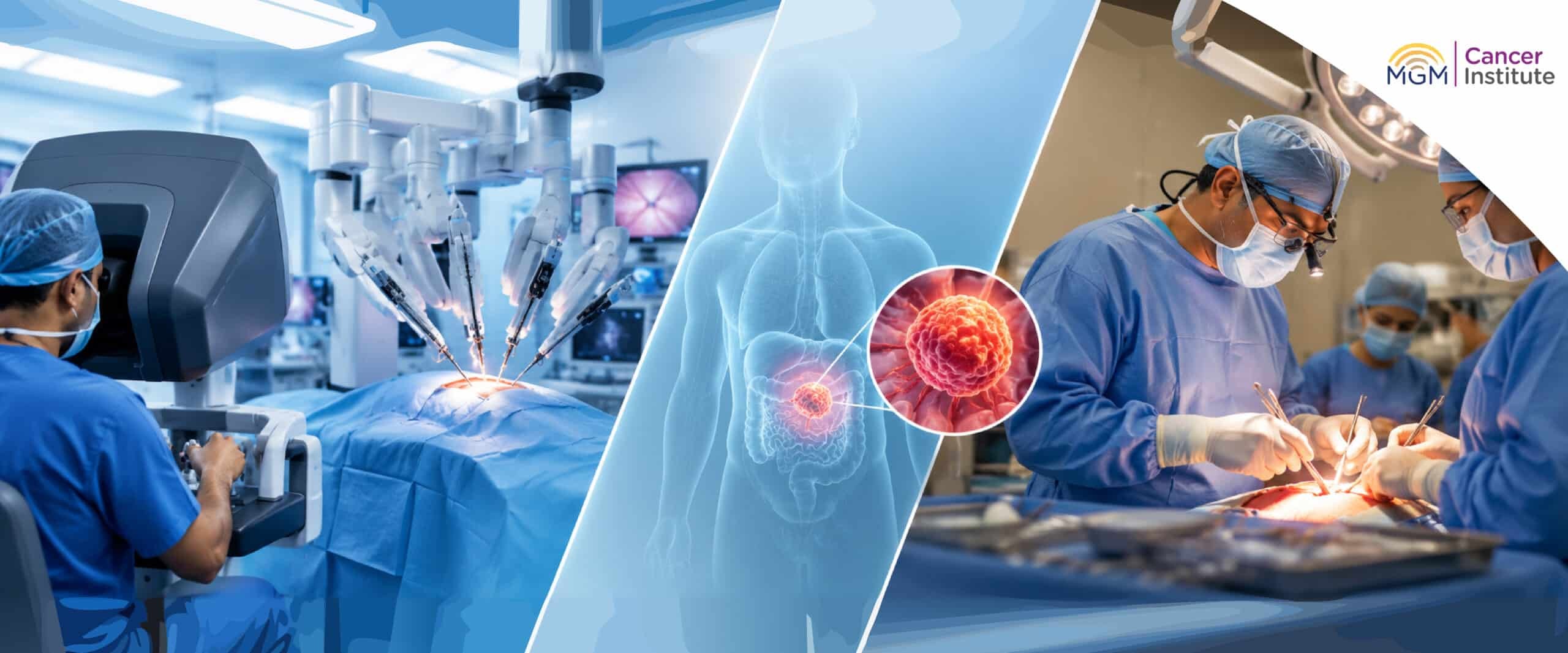Differences between robotic-assisted cancer surgery and traditional open surgery