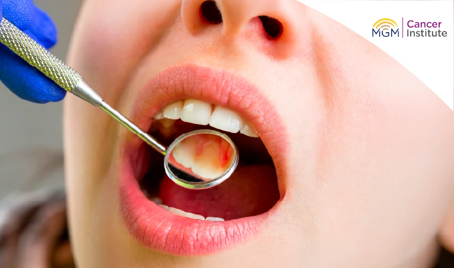 oral cancer symptoms