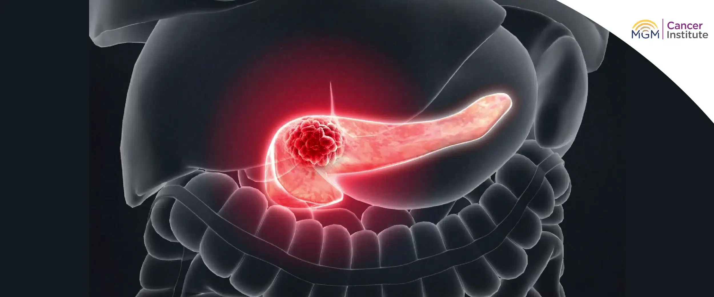 pancreatic cancer symptoms