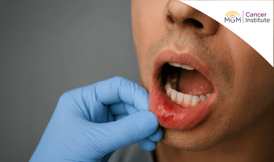 oncologist in chennai