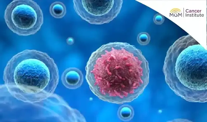 oncologist in chennai