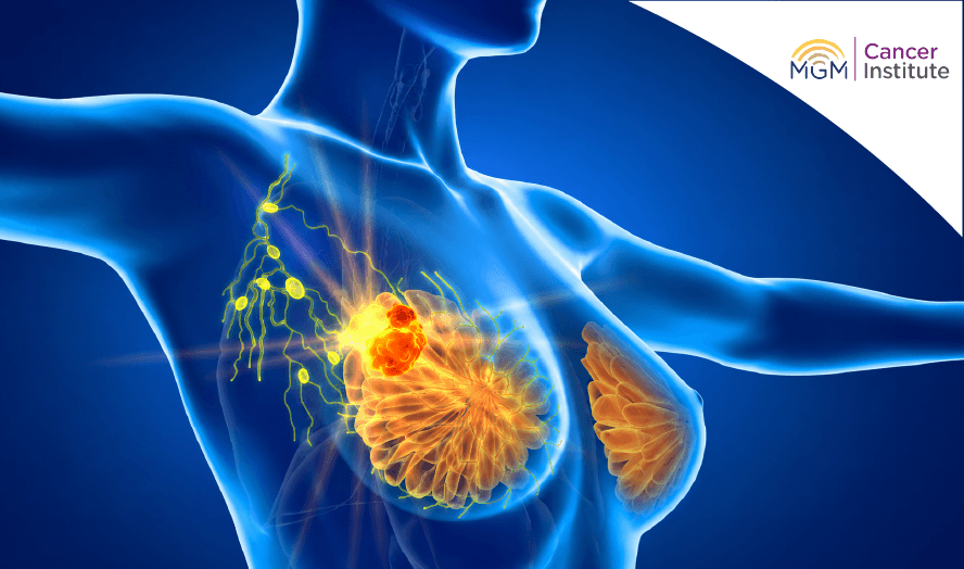 oncologist in chennai