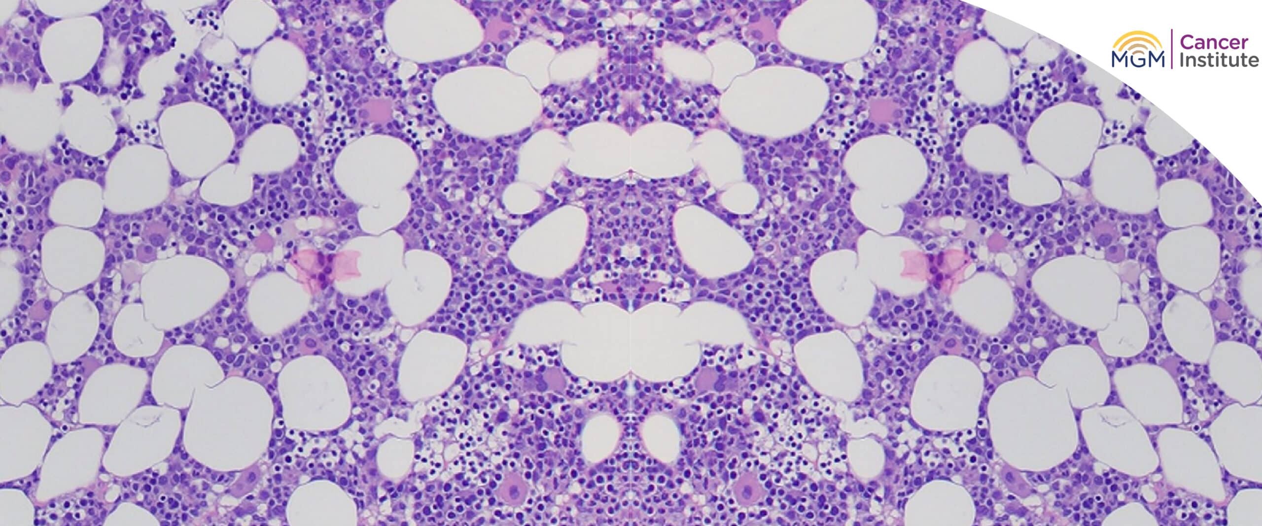 top 10 cancer hospital in chennai