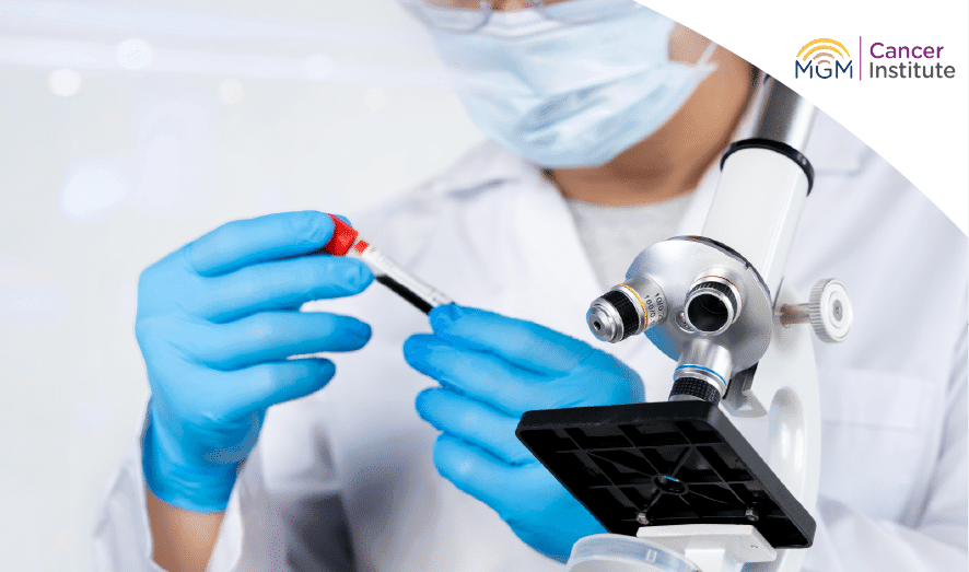 oncologist in chennai