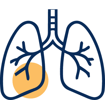 Respiratory illnesses