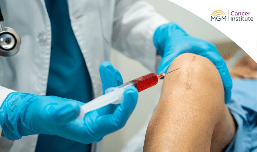 oncologist in chennai