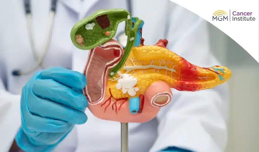 oncologist in chennai