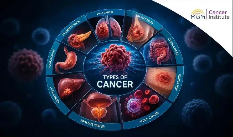 oncologist in chennai